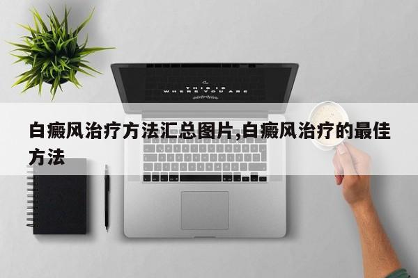 白癜风治疗方法汇总图片,白癜风治疗的最佳方法