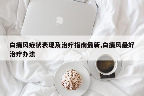白癜风症状表现及治疗指南最新,白癜风最好治疗办法